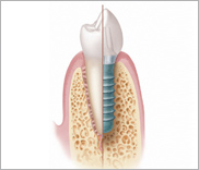 articles_item_top